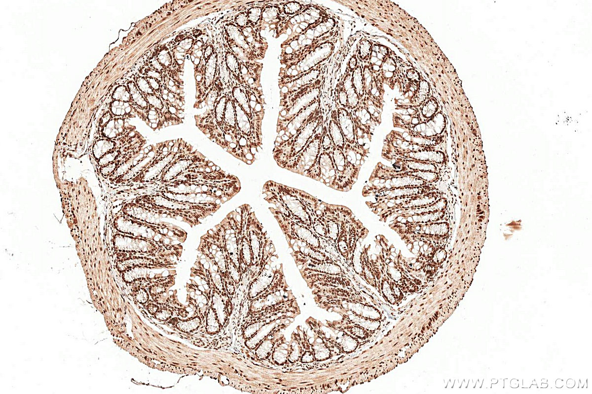 IHC staining of mouse colon using 16467-1-AP