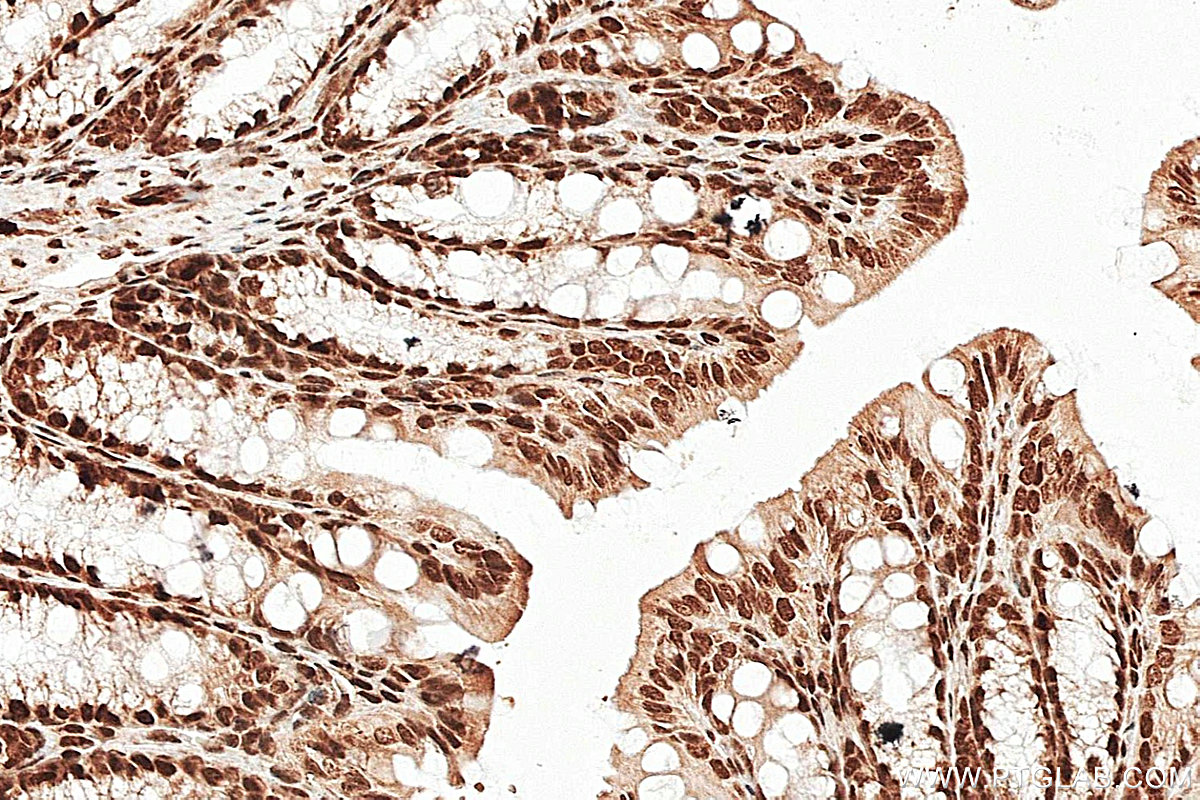 IHC staining of mouse colon using 16467-1-AP