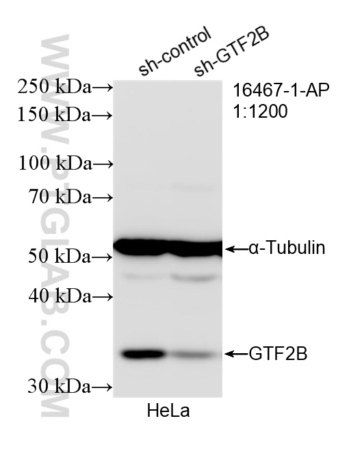 WB analysis of HeLa using 16467-1-AP