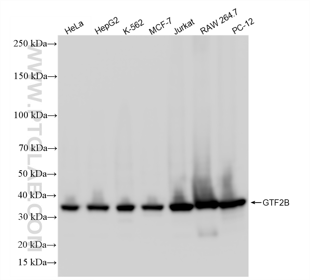 WB analysis using 87643-2-RR (same clone as 87643-2-PBS) WB analysis using 87643-2-RR (same clone as 87643-2-PBS)
