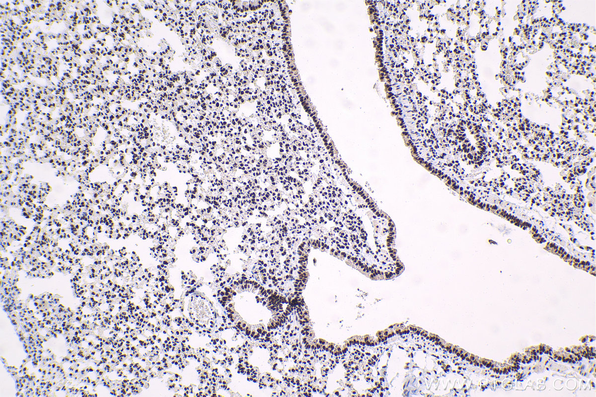 IHC staining of mouse lung using 10093-2-AP
