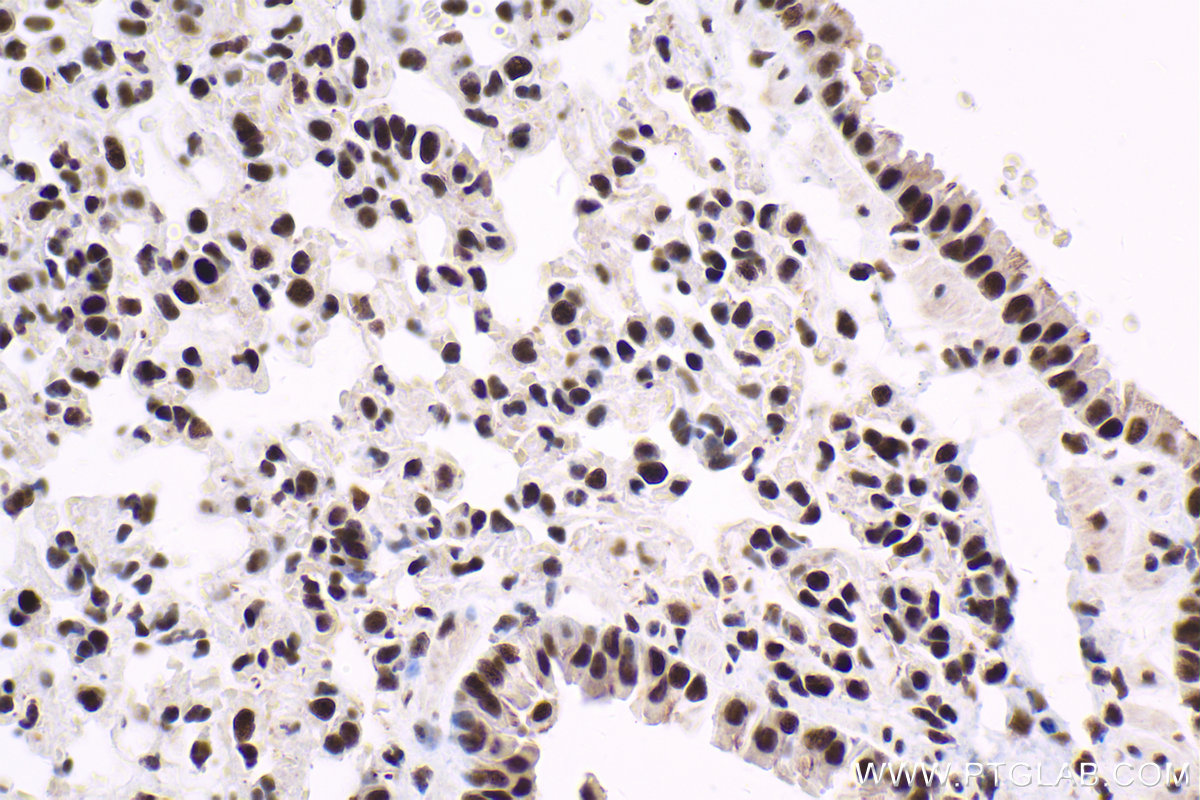 IHC staining of mouse lung using 10093-2-AP