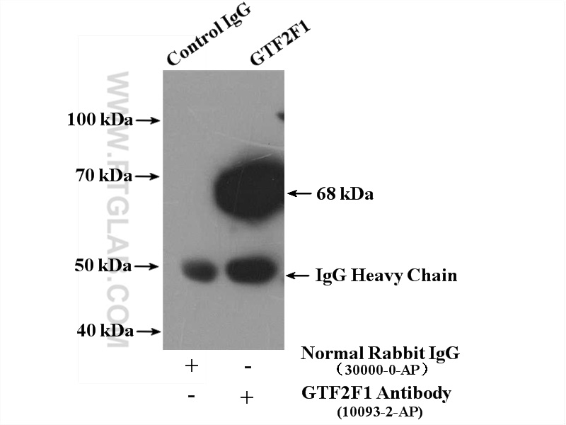 IP experiment of K-562 using 10093-2-AP