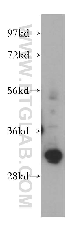 WB analysis of K-562 using 15139-1-AP (same clone as 15139-1-PBS)