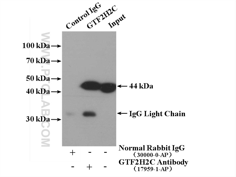 IP experiment of HepG2 using 17959-1-AP