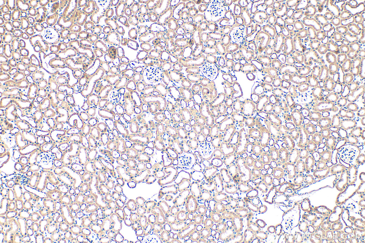IHC staining of mouse kidney using 29112-1-AP IHC staining of mouse kidney using 29112-1-AP