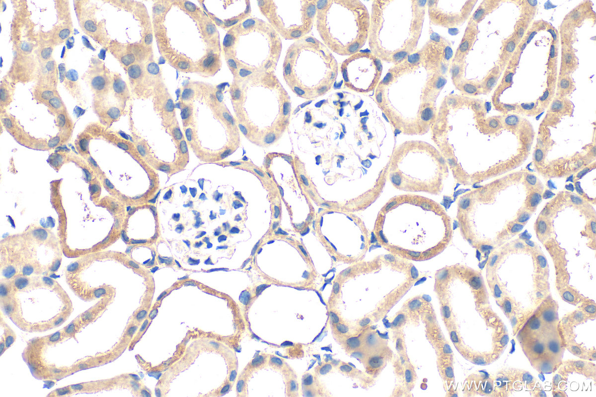 IHC staining of mouse kidney using 29112-1-AP IHC staining of mouse kidney using 29112-1-AP