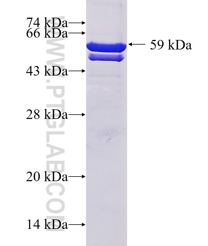 GTF2I fusion protein Ag0773 SDS-PAGE