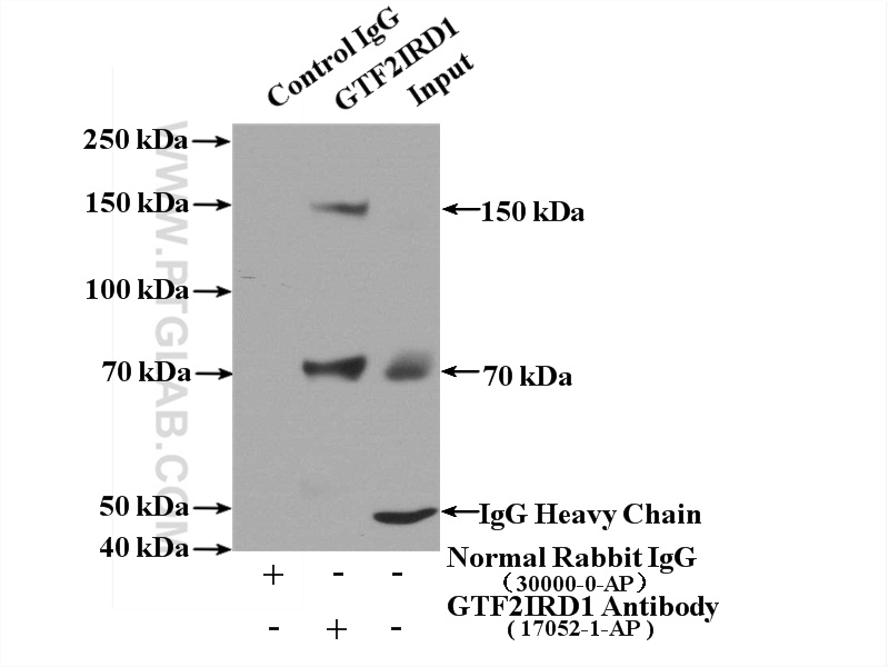 IP experiment of mouse liver using 17052-1-AP