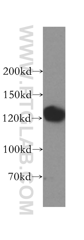 WB analysis of HeLa using 17052-1-AP