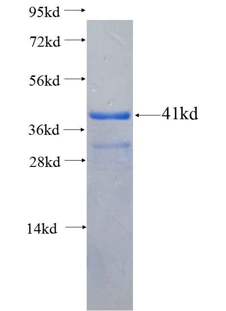 GTF3C2 fusion protein Ag26666 SDS-PAGE