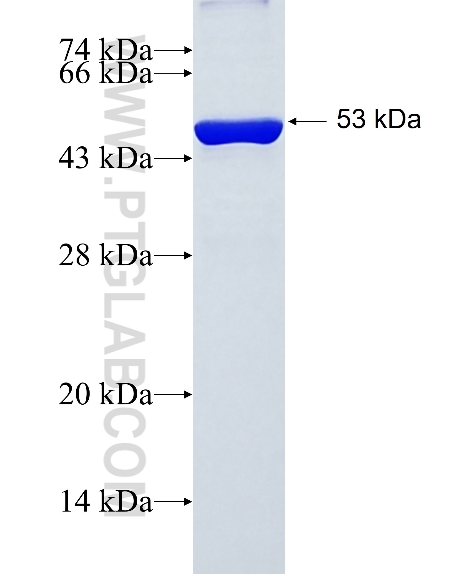 GTF3C3 fusion protein Ag38352 SDS-PAGE GTF3C3 fusion protein Ag38352 SDS-PAGE