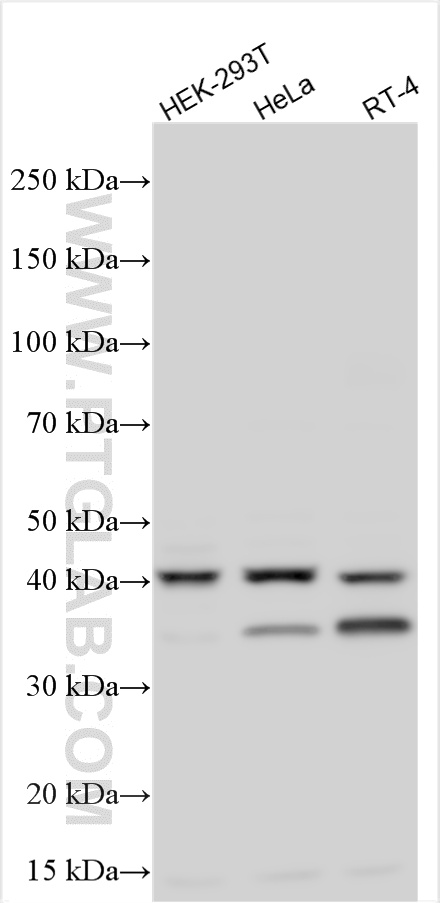 Various lysates were subjected to SDS PAGE followed by western blot with 32944-1-AP (GTPBP10 antibody) at dilution of 1:1000 incubated at room temperature for 1.5 hours. WB analysis using 32944-1-AP