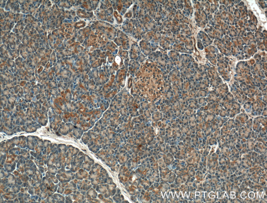 IHC staining of human pancreas using 11557-1-AP