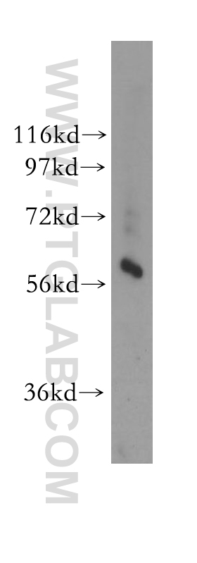 WB analysis of human kidney using 11557-1-AP