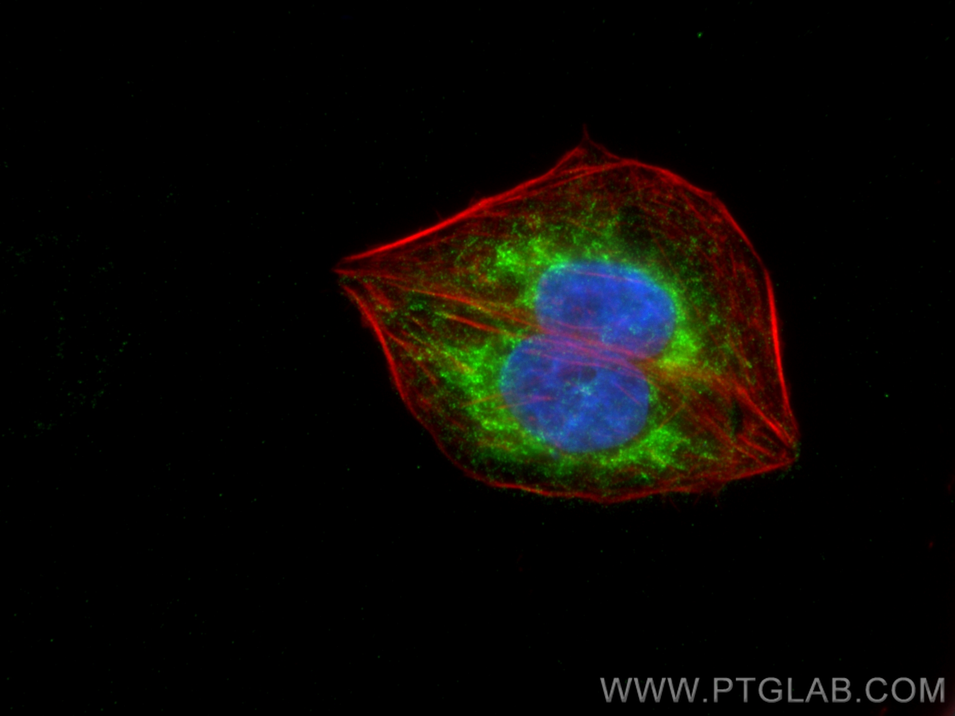 IF Staining of U2OS using 10764-1-AP