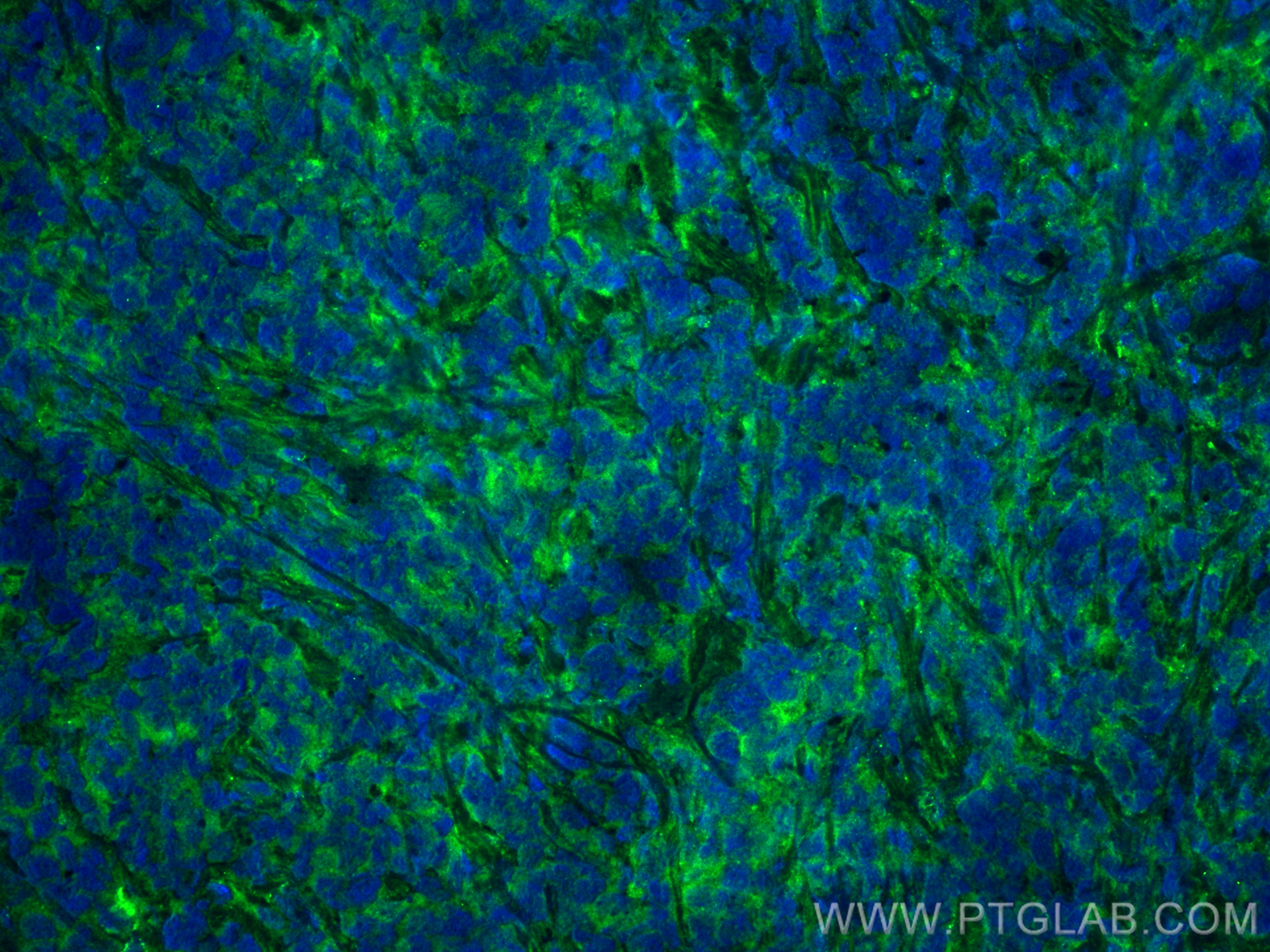 IF Staining of mouse breast cancer using 10764-1-AP