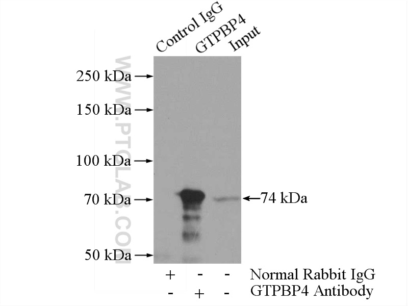 IP experiment of mouse testis using 13897-1-AP