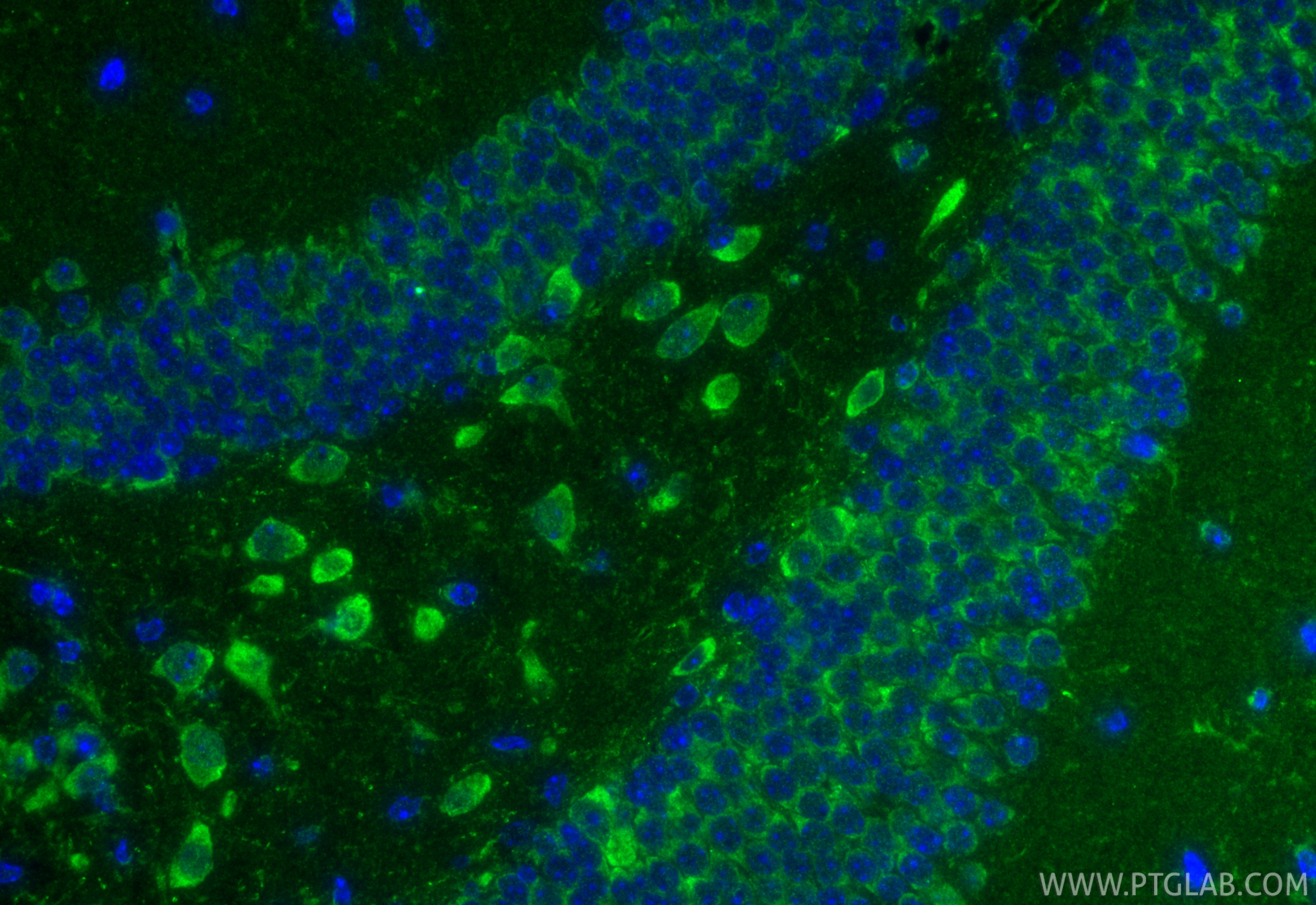 IF Staining of mouse brain using 20133-1-AP IF Staining of mouse brain using 20133-1-AP