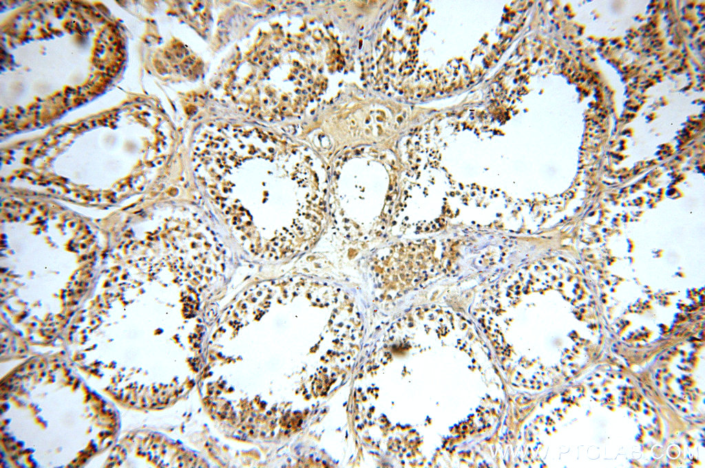 IHC staining of human testis using 20133-1-AP