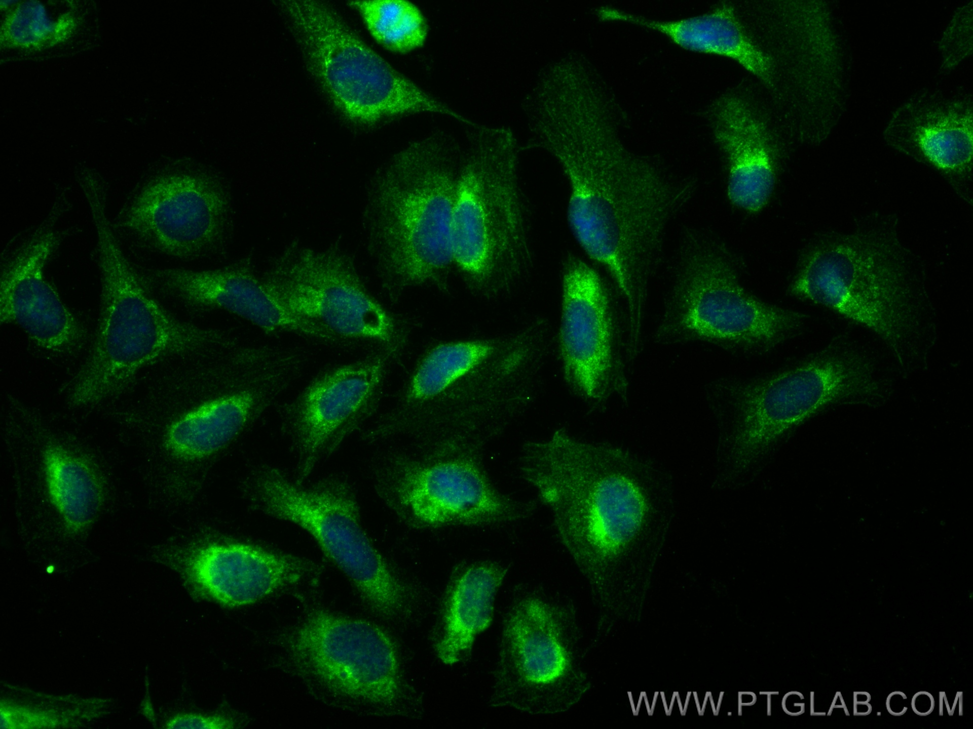 IF Staining of U2OS using 19813-1-AP