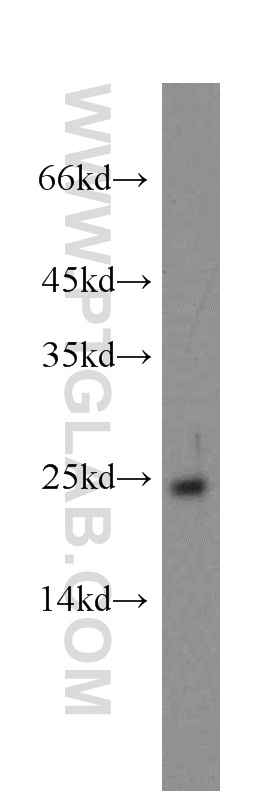 WB analysis of Y79 using 12944-1-AP