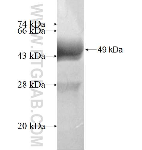 GUCA1A fusion protein Ag4017 SDS-PAGE