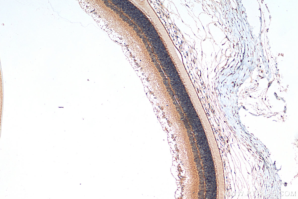 IHC staining of rat eye using 21531-1-AP IHC staining of rat eye using 21531-1-AP