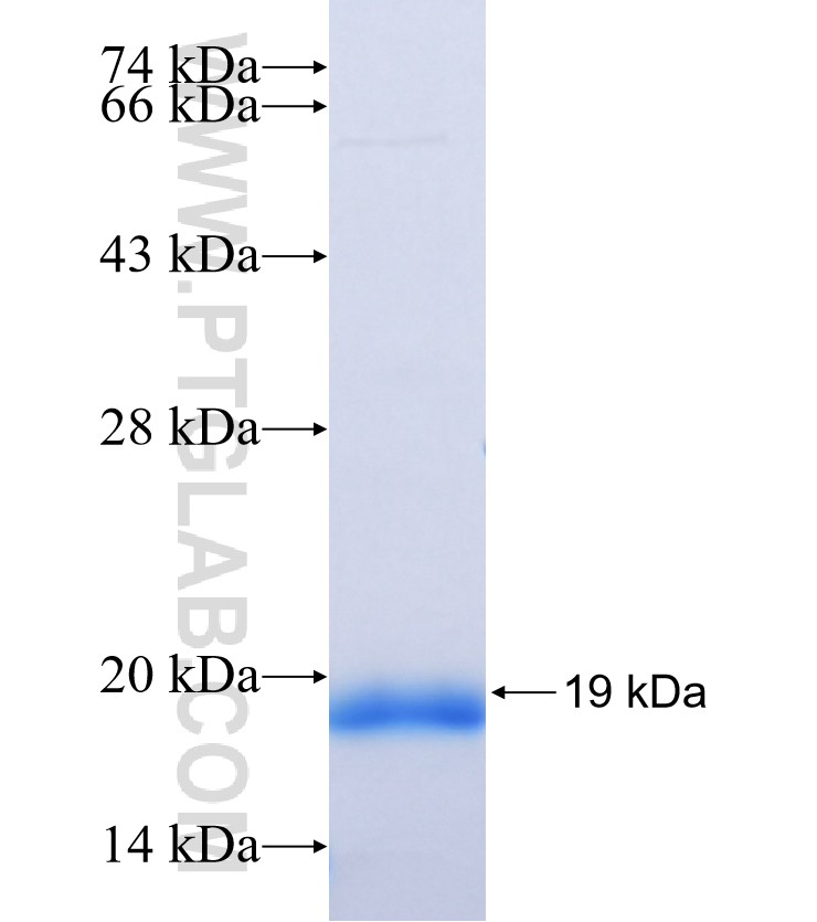 GUCA2A fusion protein Ag37495 SDS-PAGE