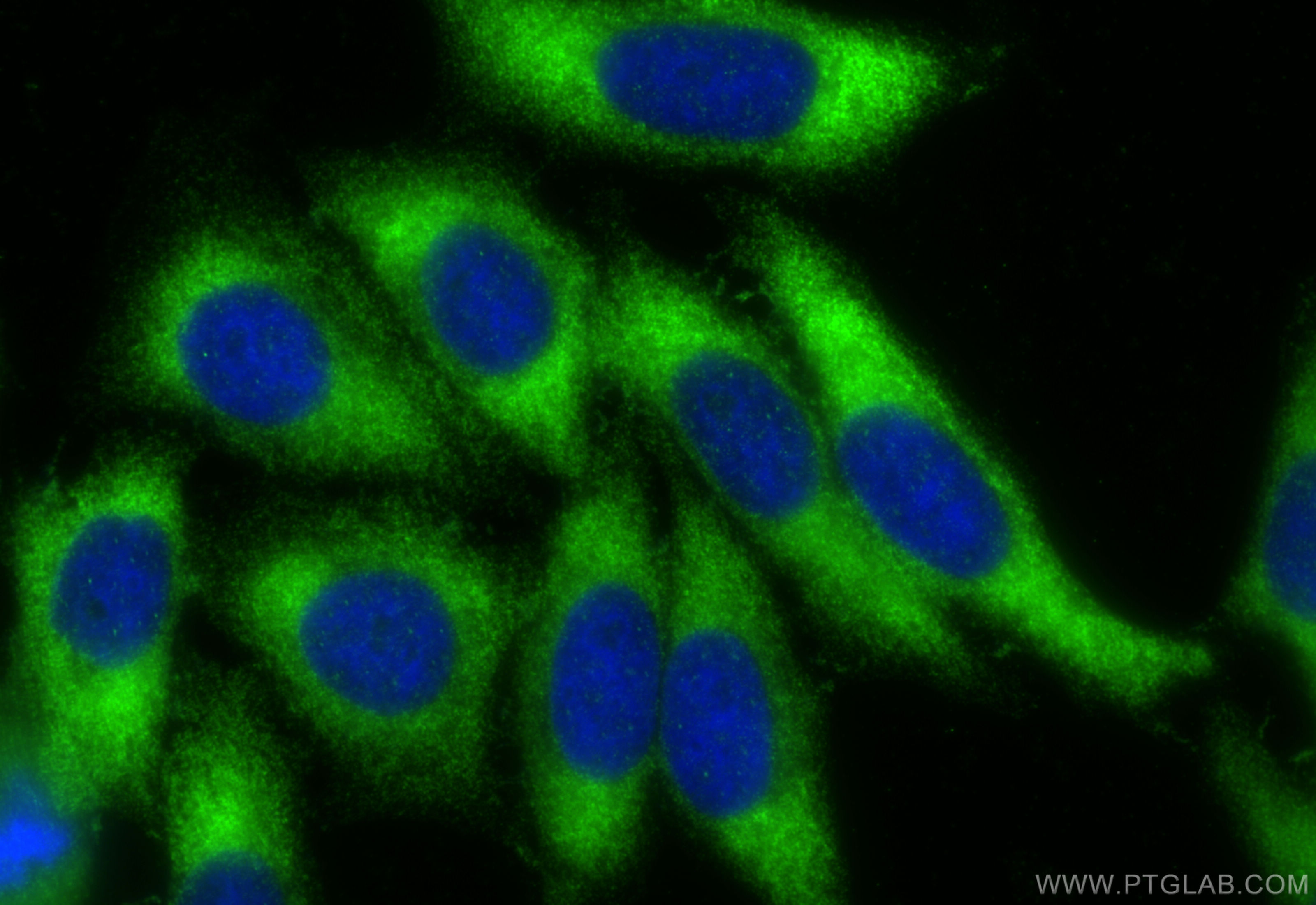IF Staining of HepG2 using 18113-1-AP