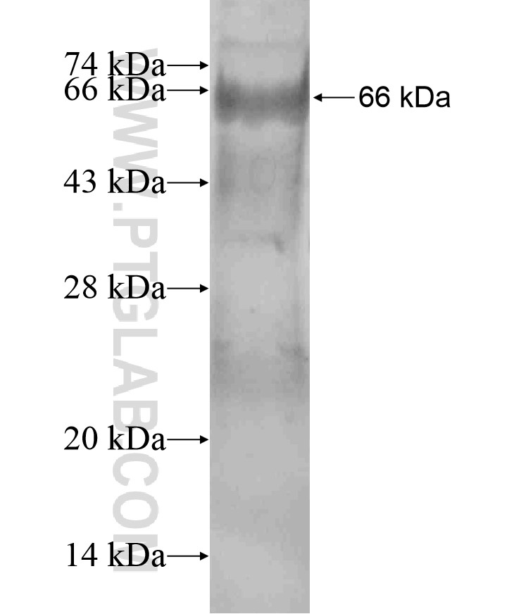 GUCY1A2 fusion protein Ag18136 SDS-PAGE GUCY1A2 fusion protein Ag18136 SDS-PAGE