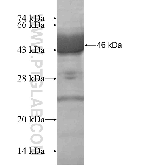 GUCY1A2 fusion protein Ag19325 SDS-PAGE GUCY1A2 fusion protein Ag19325 SDS-PAGE