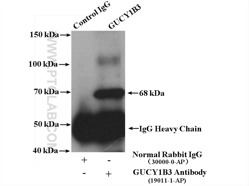 IP experiment of human placenta using 19011-1-AP