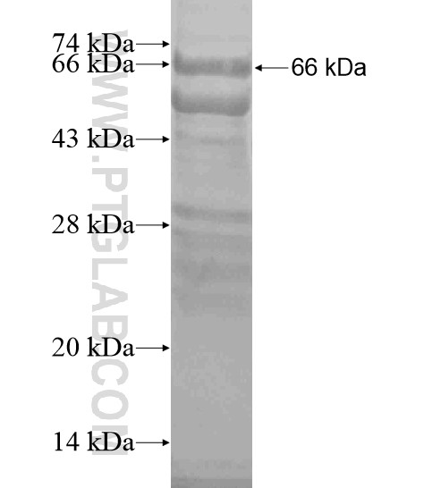 GUCY2C fusion protein Ag19207 SDS-PAGE GUCY2C fusion protein Ag19207 SDS-PAGE