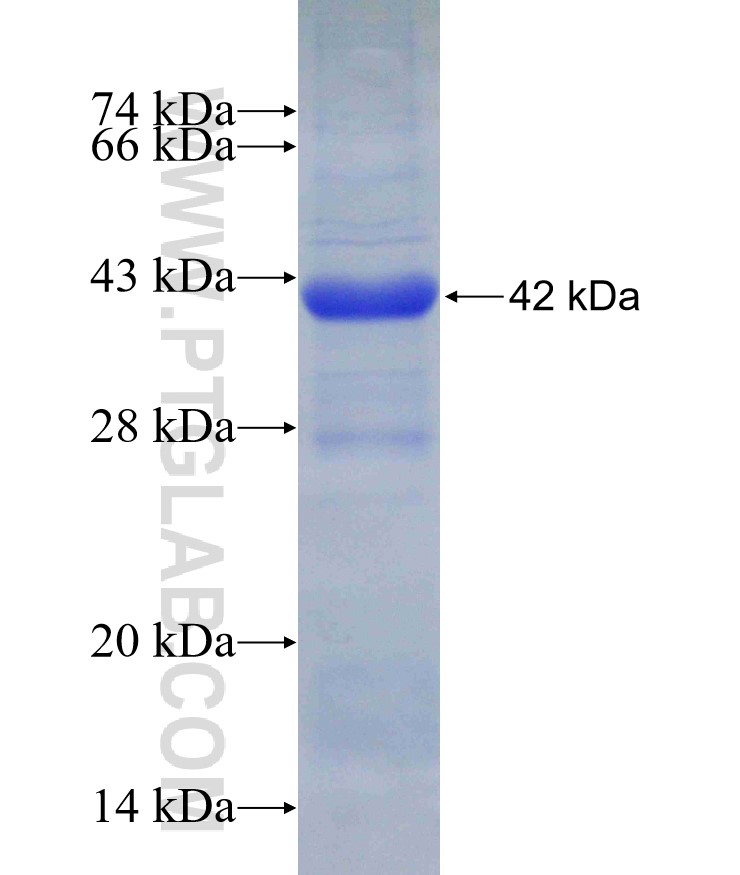 GUCY2C fusion protein Ag19256 SDS-PAGE