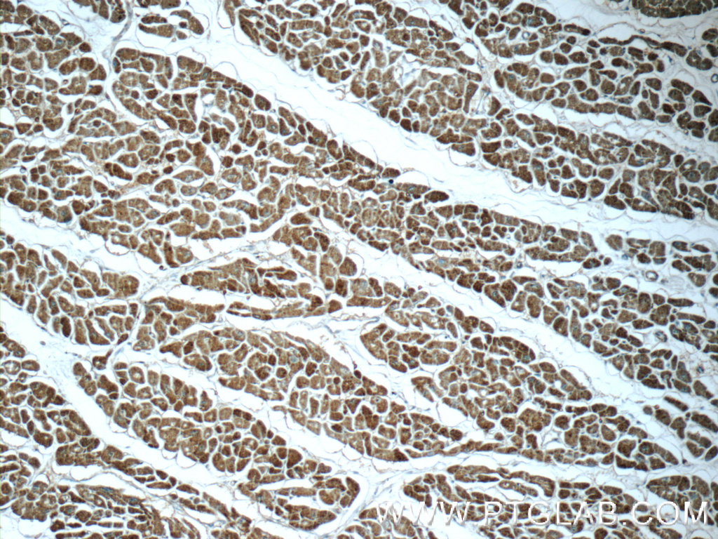 IHC staining of human heart using 25252-1-AP