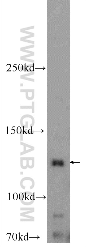 WB analysis of mouse heart using 25252-1-AP