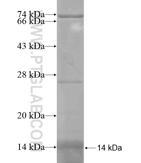 GUSBL1 fusion protein Ag19673 SDS-PAGE GUSBL1 fusion protein Ag19673 SDS-PAGE