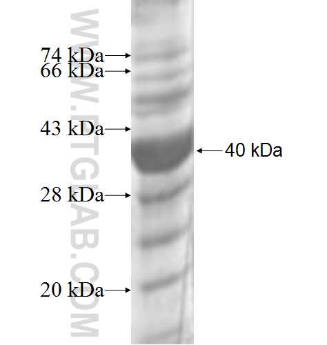 GYLTL1B fusion protein Ag8296 SDS-PAGE GYLTL1B fusion protein Ag8296 SDS-PAGE