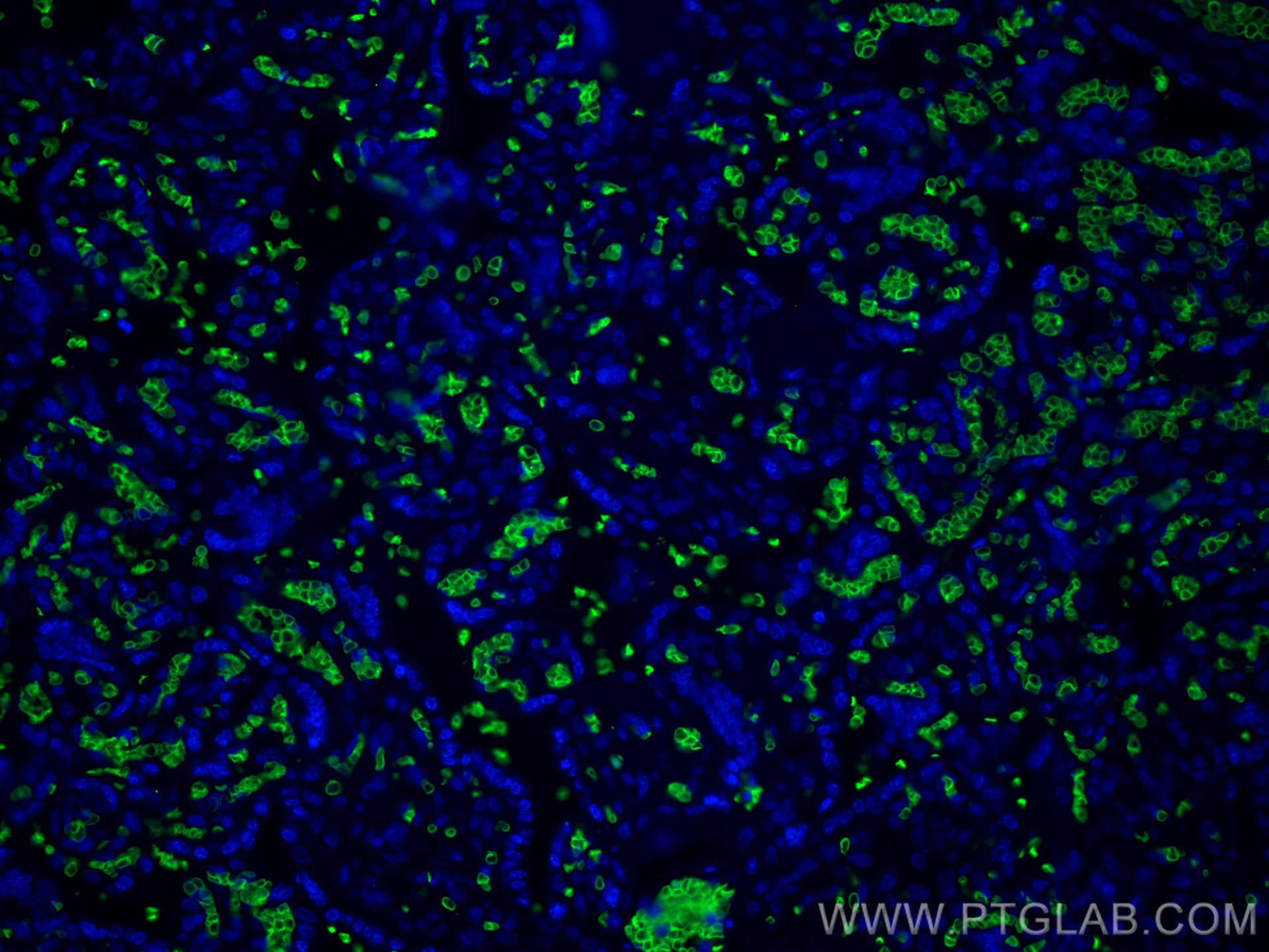 IF Staining of human placenta using 15874-1-AP