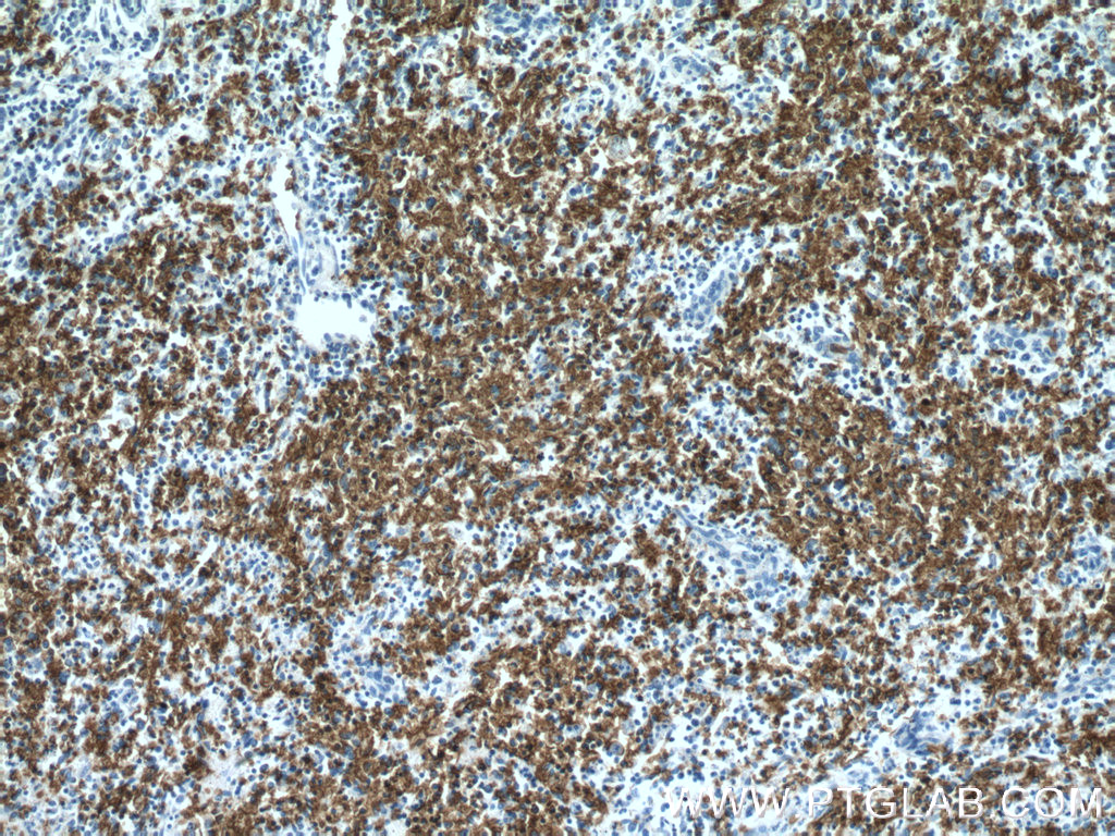 IHC staining of human spleen using 15874-1-AP