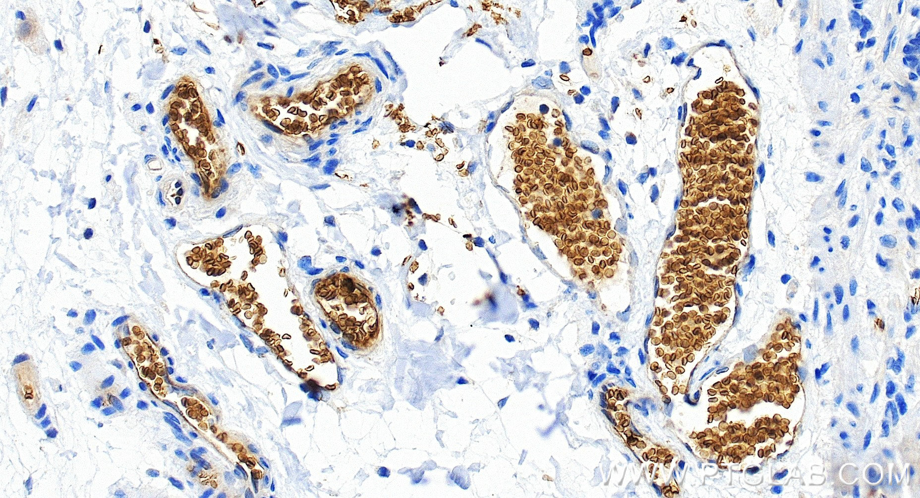 Immunohistochemical analysis of paraffin-embedded human colon tissue slide using <a class='green' href='/productredirect?CatalogNo=85182-3-RR' target='_blank'>85182-3-RR</a> (Glycophorin A/CD235a antibody) at dilution of 1:2000 (under 20x lens). Heat mediated antigen retrieval with Tris-EDTA buffer (pH 9.0). This data was developed using the same antibody clone with 85182-3-PBS in a different storage buffer formulation. IHC staining of human colon using 85182-3-RR (same clone as 85182-3-PBS)
