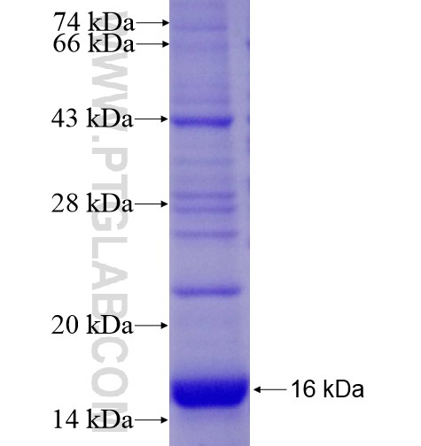 GYPB fusion protein Ag12919 SDS-PAGE GYPB fusion protein Ag12919 SDS-PAGE
