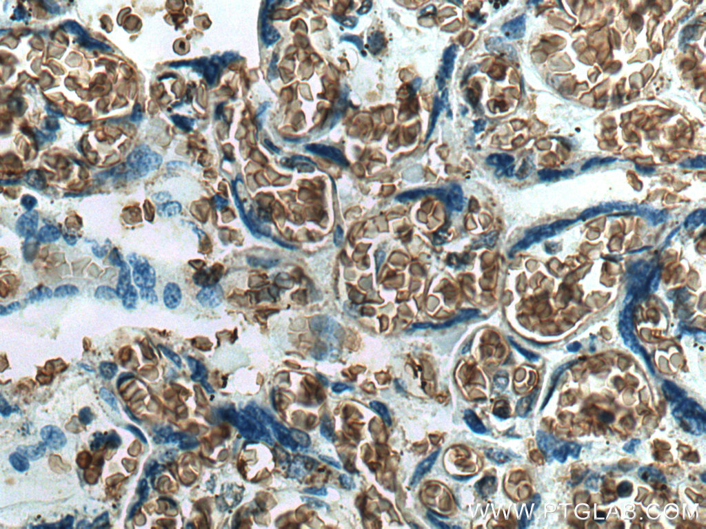 IHC staining of human placenta using 18147-1-AP