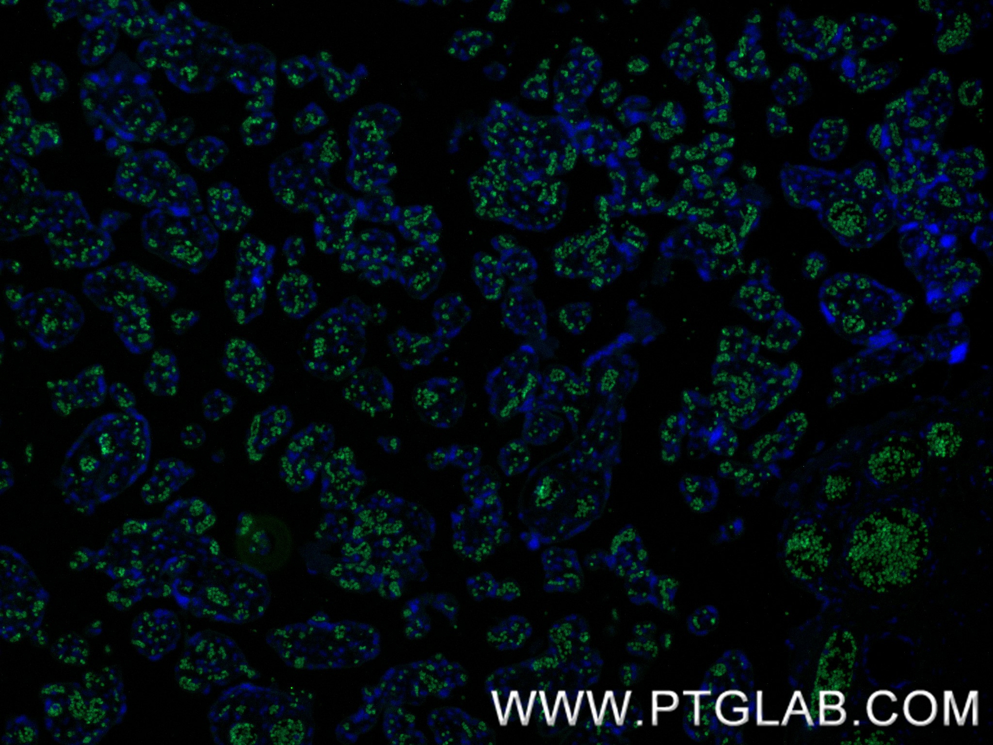 IF Staining of human placenta using 86574-1-RR IF Staining of human placenta using 86574-1-RR