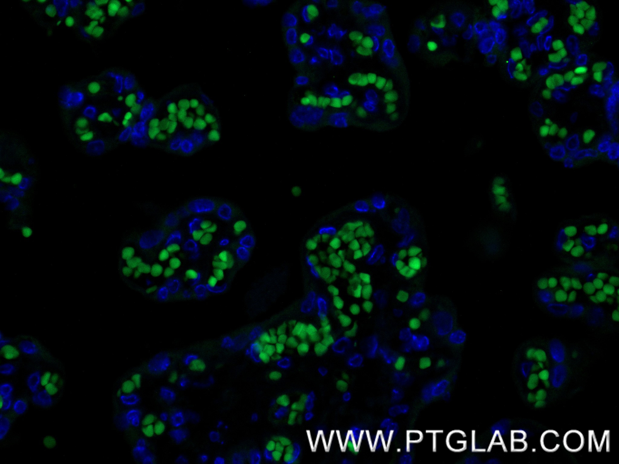 IF Staining of human placenta using 86574-1-RR IF Staining of human placenta using 86574-1-RR