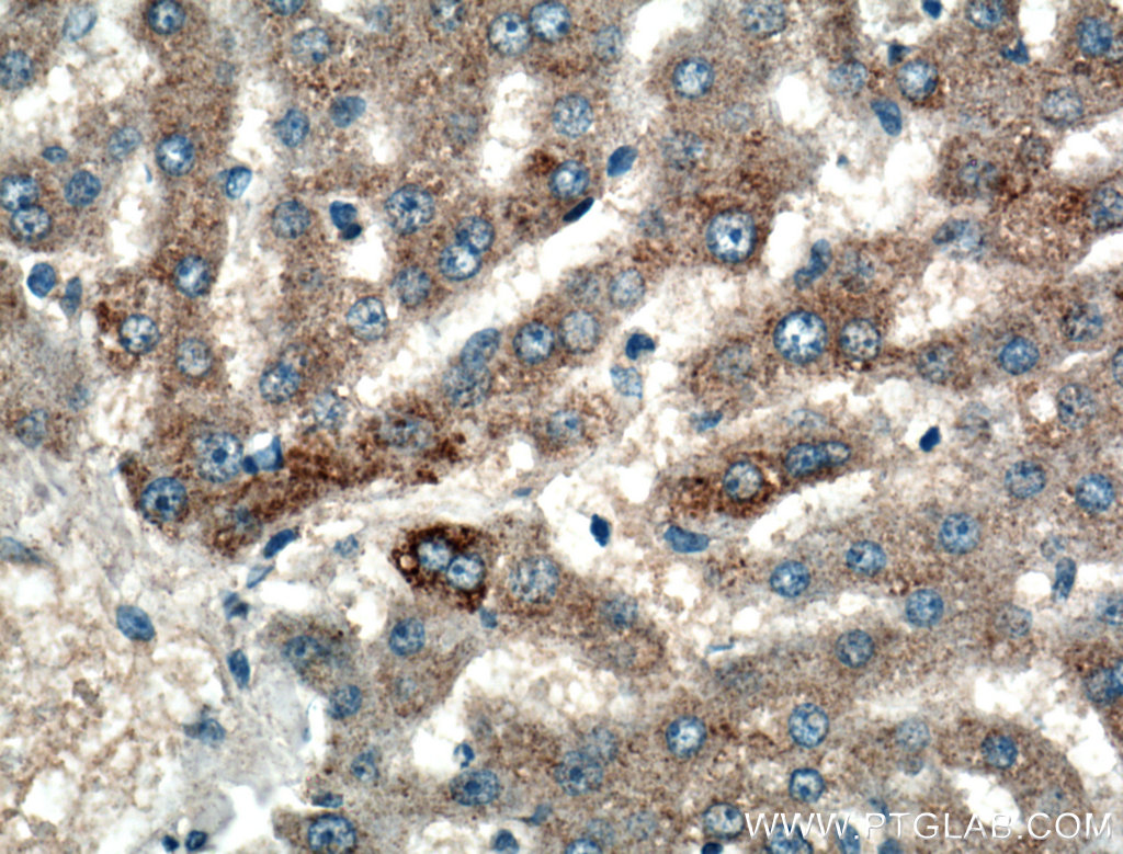 IHC staining of human liver using 10566-1-AP