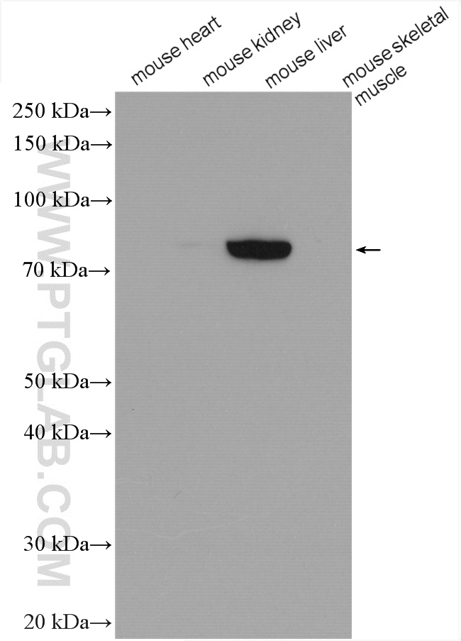 WB analysis of mouse liver using 22371-1-AP WB analysis of mouse liver using 22371-1-AP