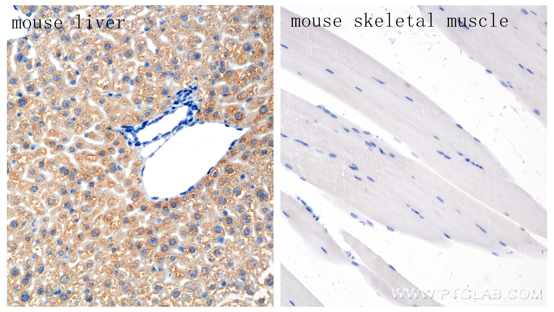 IHC staining of mouse liver using 85122-4-RR