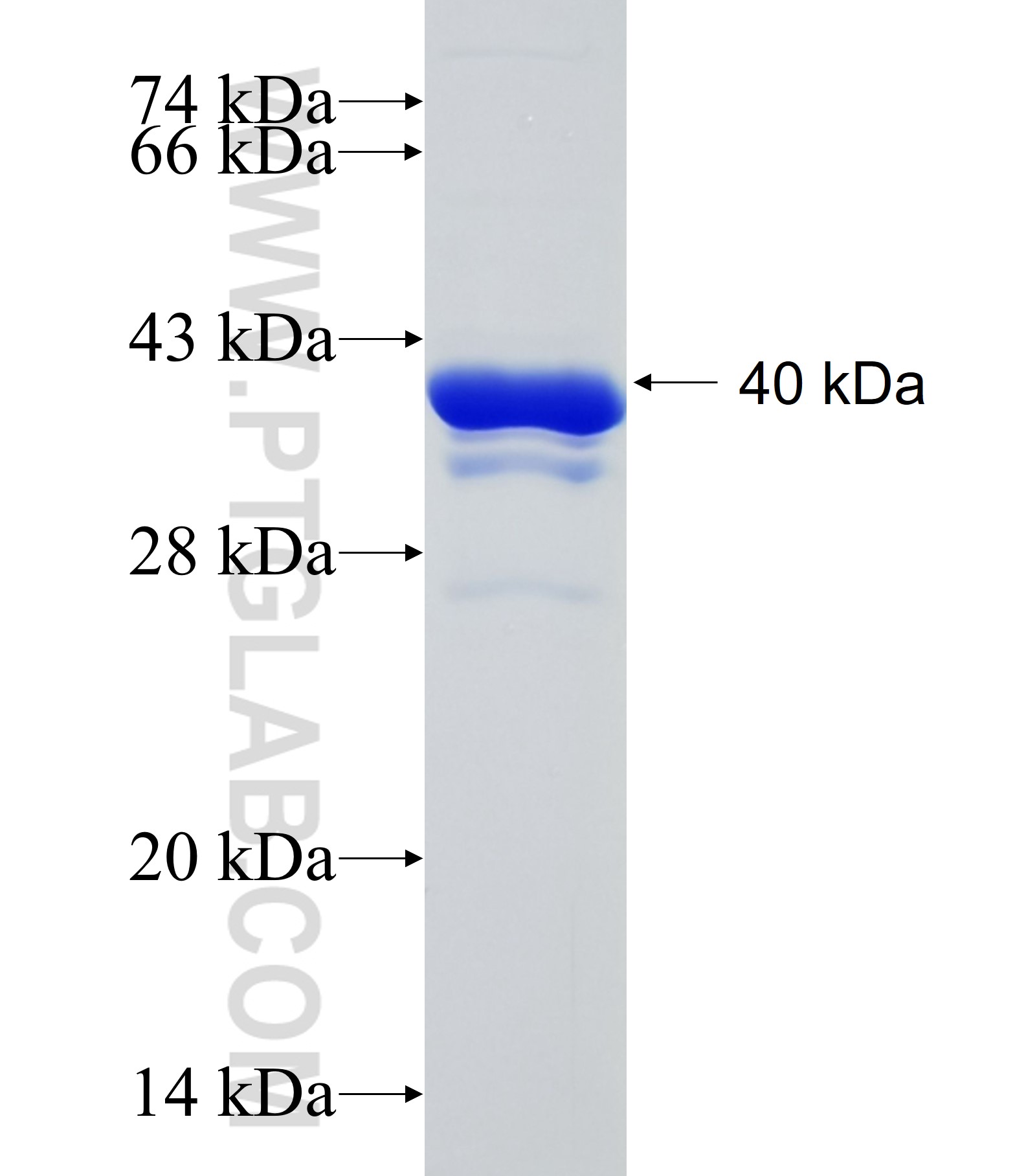 GYS2 fusion protein Ag18012 SDS-PAGE